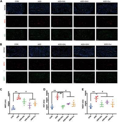 Corrigendum: Shu-Xie decoction alleviates oxidative stress and colon injury in acute sleep-deprived mice by suppressing p62/KEAP1/NRF2/HO1/NQO1 signaling